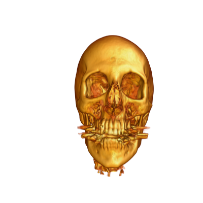 transfer_function_image_01